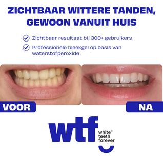 WTF | Whitening Traject