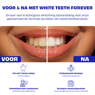 WTF | Whitening Traject